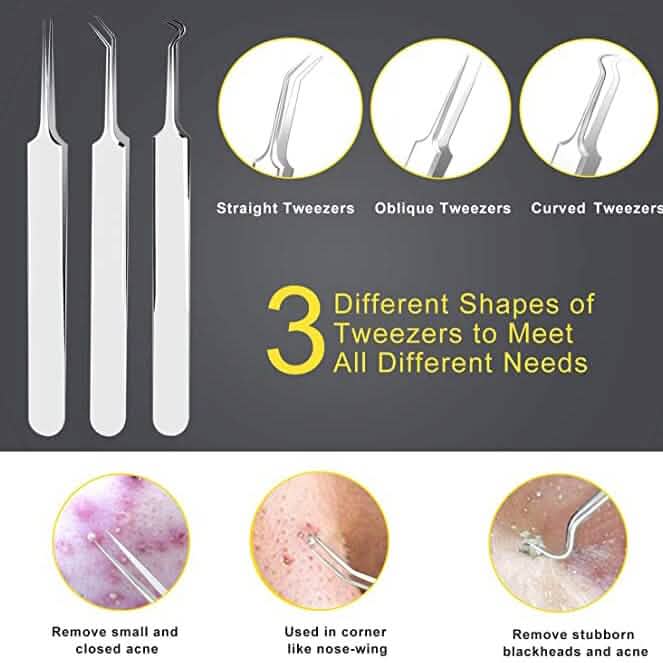 10-Piece: Blackhead Remover Tool-10-Piece: Blackhead Remover Tool