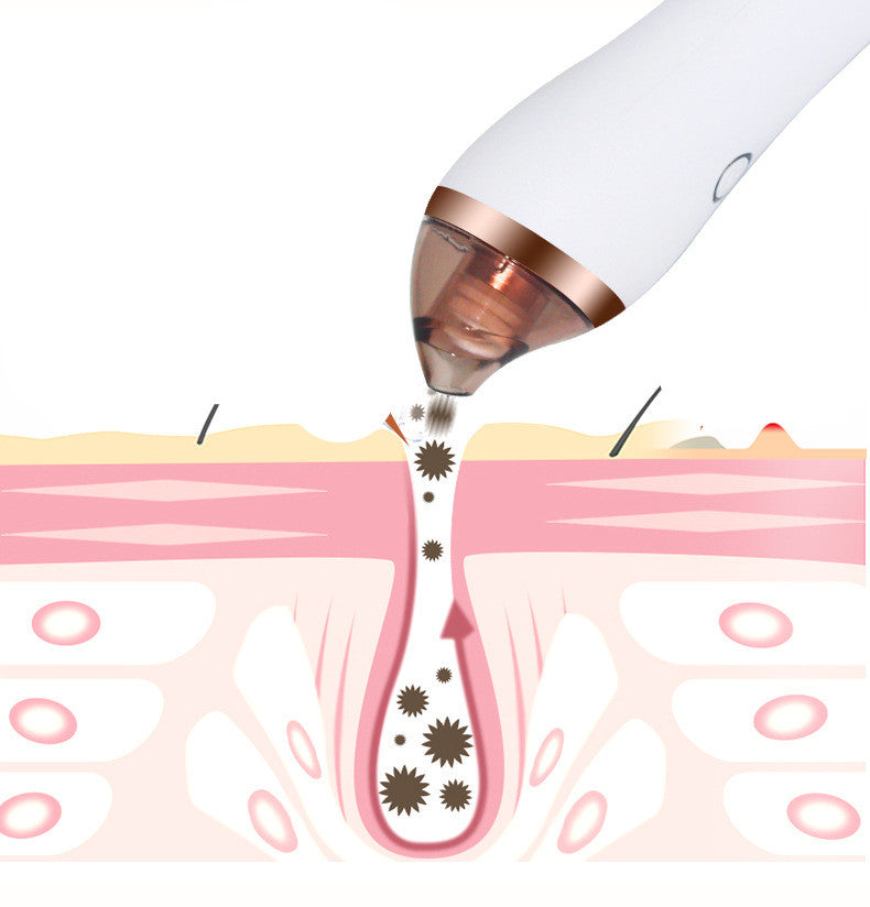 4 in 1 Body Guasha Cupping Blackhead Remover Machine Facial Pore Deep Cleansing Beauty Skin Care-6cc0ba73c539f655f18735e42f13bca0