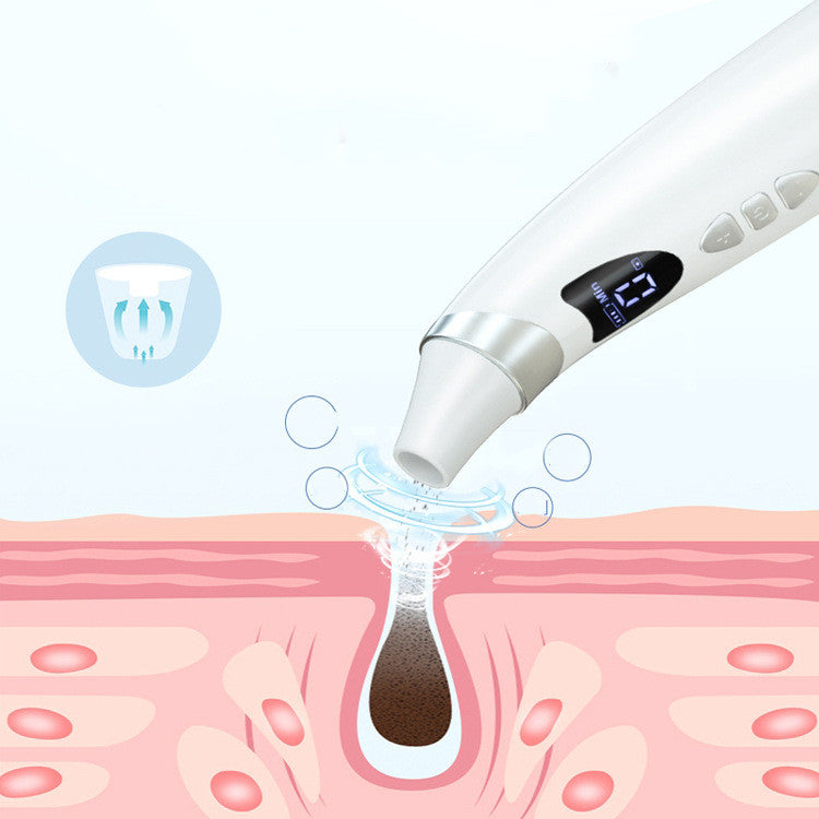 Electric Visual Blackhead Suction Instrument Household Cleansing Pore Cleaner For Skin Equipment Skin Care Tool-4da352f507b4a4b6edf5336046cb732f
