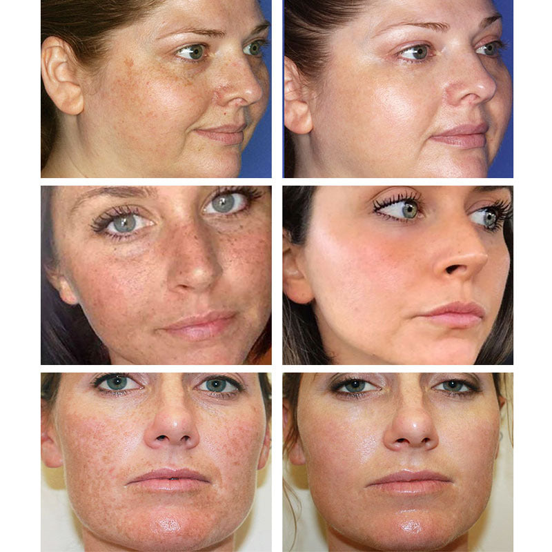 Moisturizing Cream Pore Shrinking Cream-cd6c0b411e7842d8488a5c68c89c7648