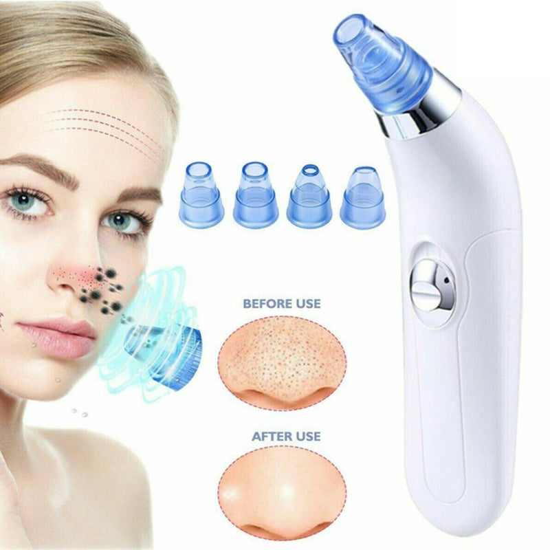 Blackhead Electric Pore Export Blackhead Cleaner-4de4e677e8b3b78c94564ba95bc39285