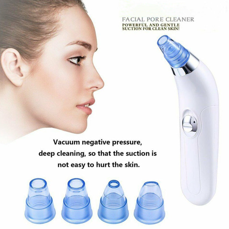 Blackhead Electric Pore Export Blackhead Cleaner-991e51d60287e3bd8ba2e35e7ccae315