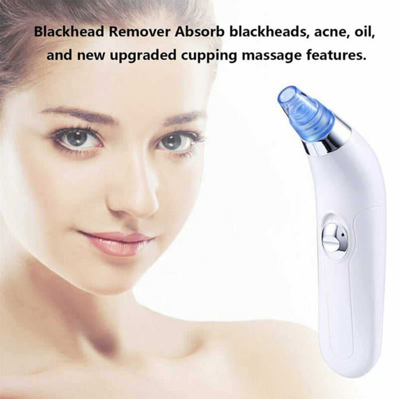 Blackhead Electric Pore Export Blackhead Cleaner-e873f85cda666b5e43c285ba11f516d7