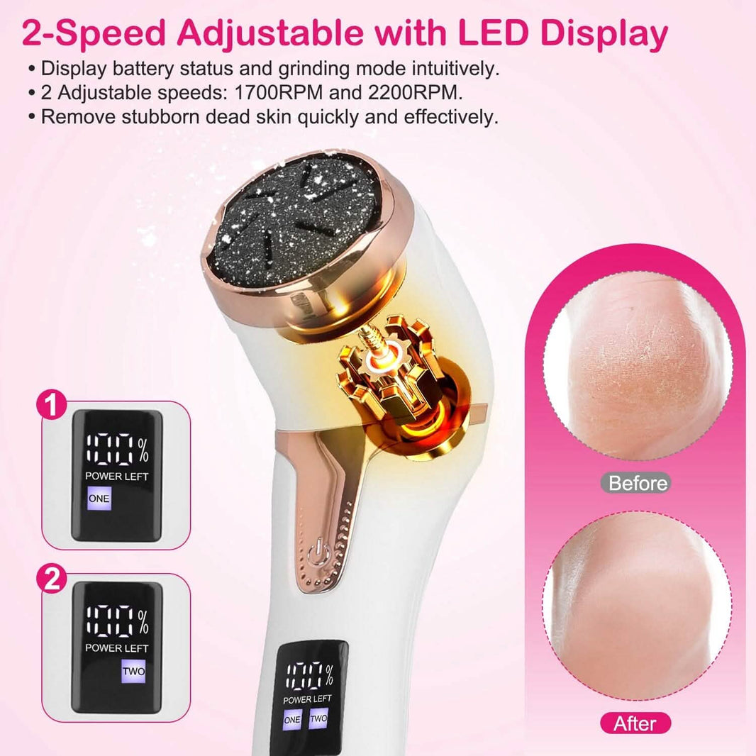 17-Pieces Set: Electric Foot Callus Remover with Vacuum Foot Grinder Rechargeable-17-Pieces Set: Electric Foot Callus Remover with Vacuum Foot Grinder Rechargeable
