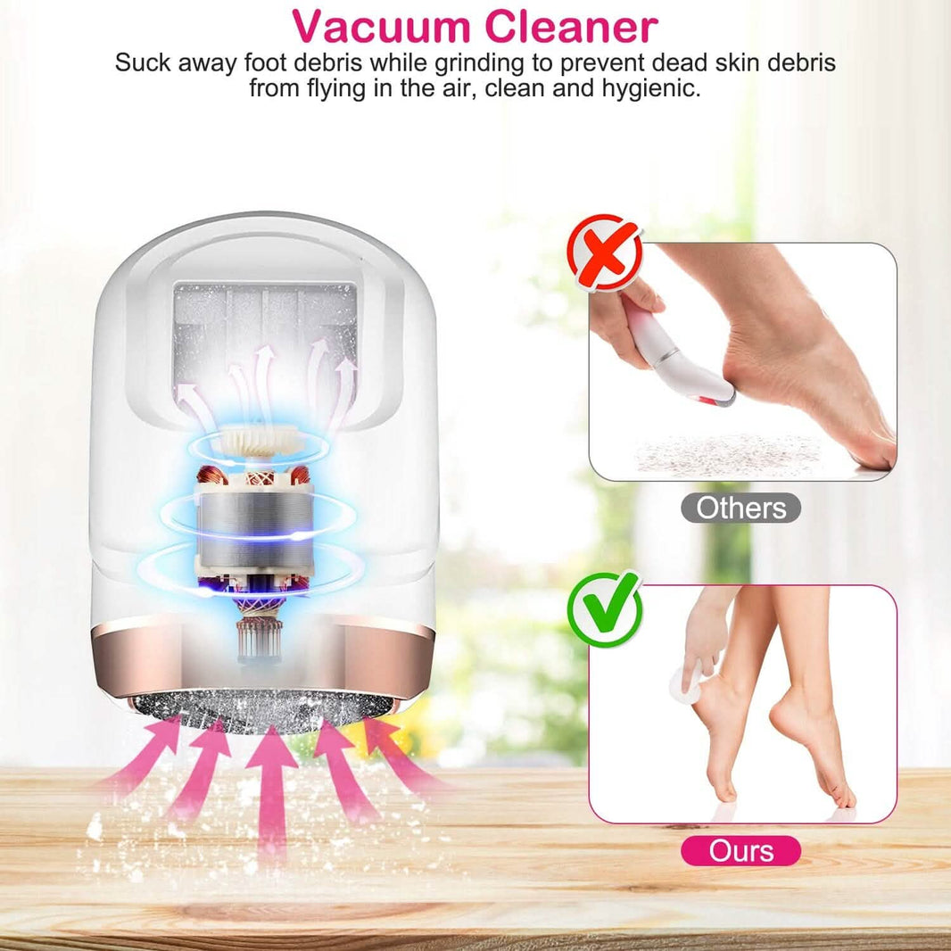 17-Pieces Set: Electric Foot Callus Remover with Vacuum Foot Grinder Rechargeable-17-Pieces Set: Electric Foot Callus Remover with Vacuum Foot Grinder Rechargeable