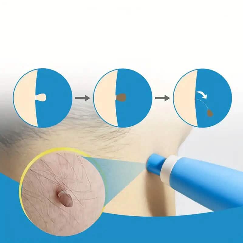 Advanced Auto Skin Tag Repair Kit-Advanced Auto Skin Tag Repair Kit