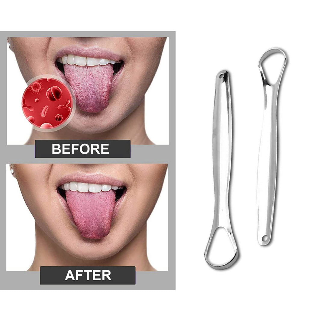 2-Pack: Stainless Steel Tongue Cleaner Scraper-2-Pack: Stainless Steel Tongue Cleaner Scraper