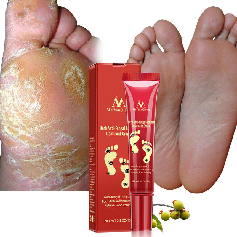 Beauty face foot cream-9f0bf6ad61fd47e6f77ef56f97a663bc