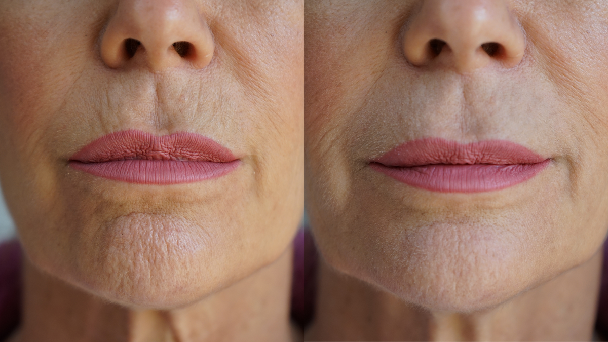 Ageless Lip & Line Filler-Ageless Lip & Line Filler