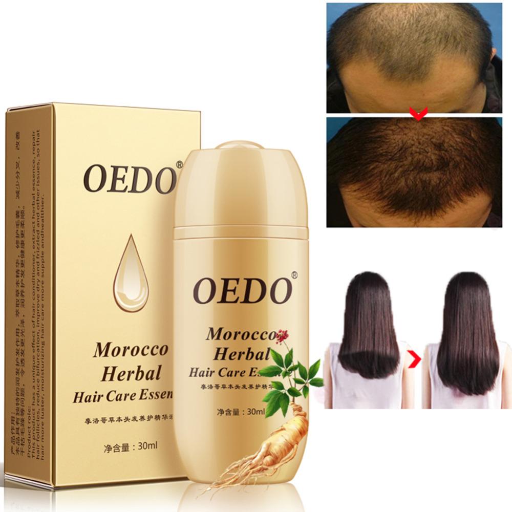 Moroccan Herbal Hair Treatment Serum-175740821763cdc1316ba85630f06f6b