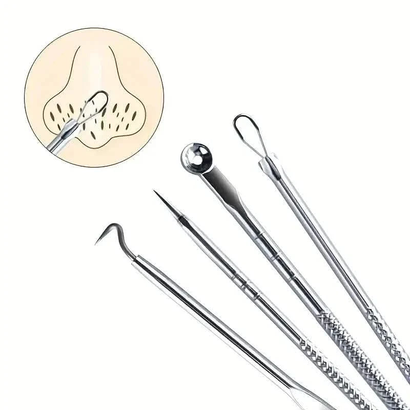 4-Piece Set: Blackhead Remover Tool for Blackheads, Acne and Dark Spots-4-Piece Set: Blackhead Remover Tool for Blackheads, Acne and Dark Spots