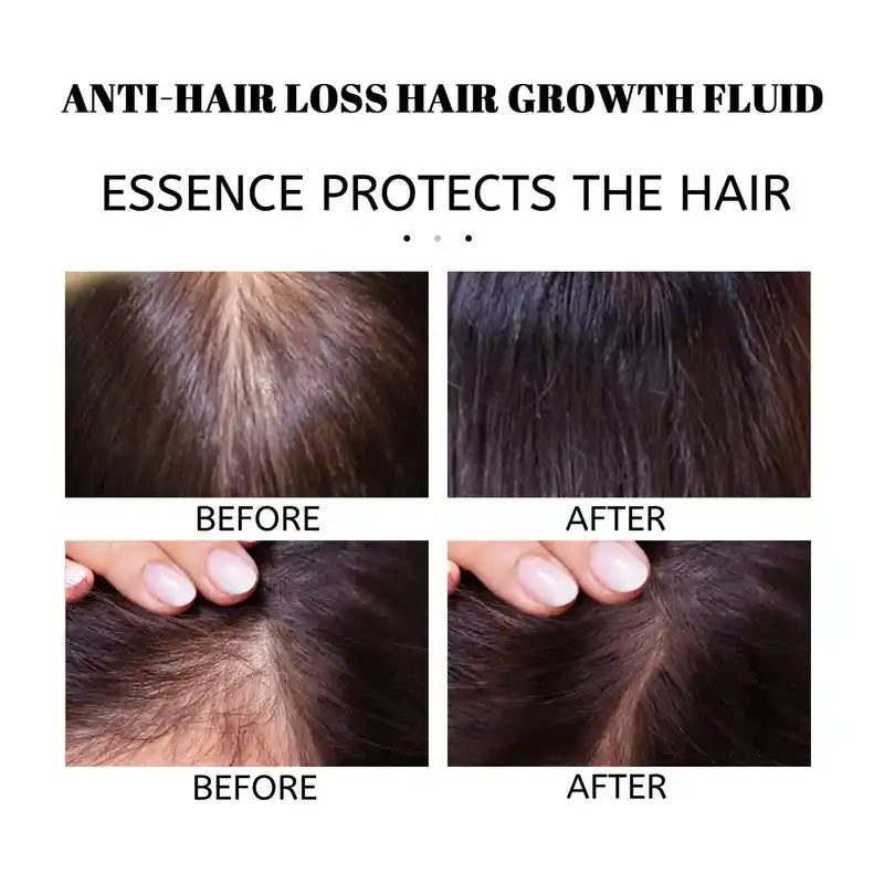 Hair Care Essential Oil Disposable Hair Care Solution-10c3145952ddb6ad3e8d1aab40e333e5