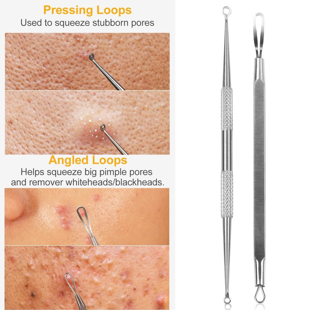 5-Piece Set: Blackhead Remover Kit Stainless Steel Popping Zit Remover-5-Piece Set: Blackhead Remover Kit Stainless Steel Popping Zit Remover