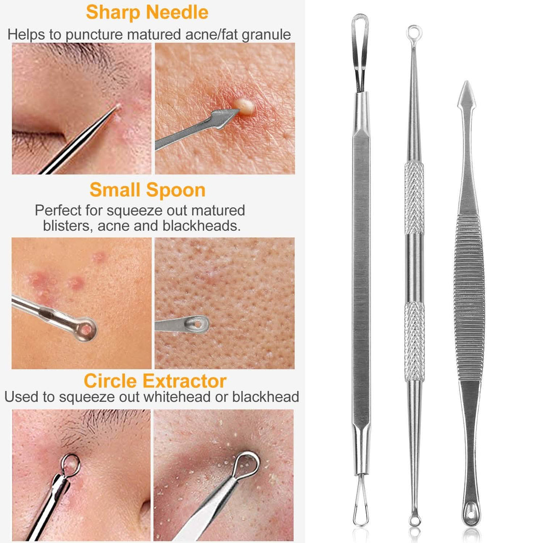 5-Piece Set: Blackhead Remover Kit Stainless Steel Popping Zit Remover-5-Piece Set: Blackhead Remover Kit Stainless Steel Popping Zit Remover