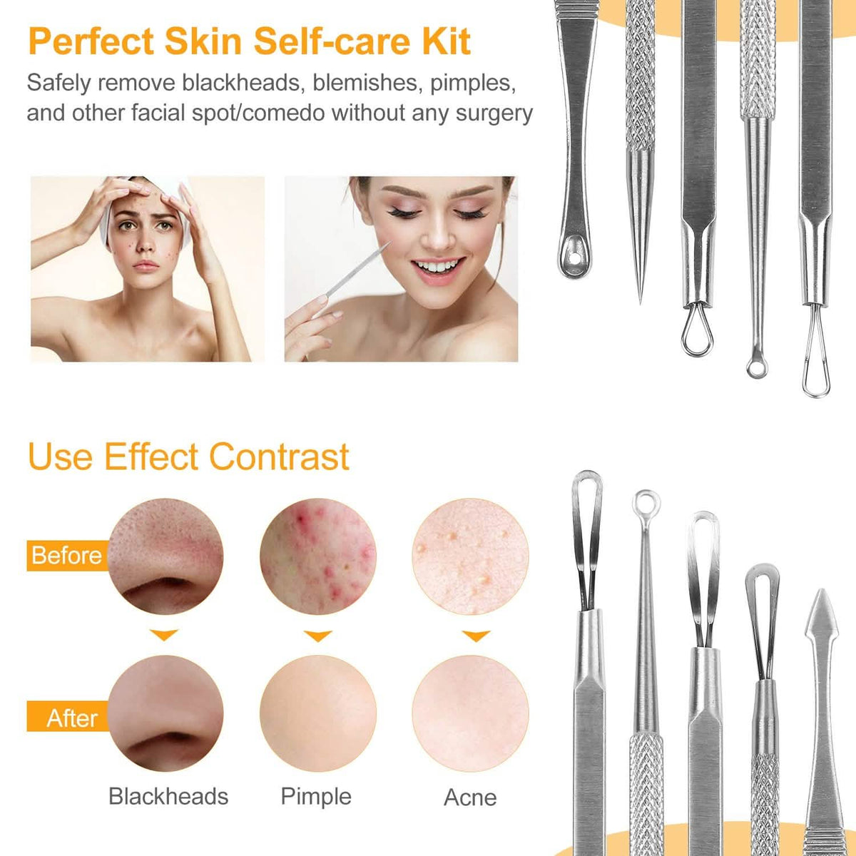5-Piece Set: Blackhead Remover Kit Stainless Steel Popping Zit Remover-5-Piece Set: Blackhead Remover Kit Stainless Steel Popping Zit Remover