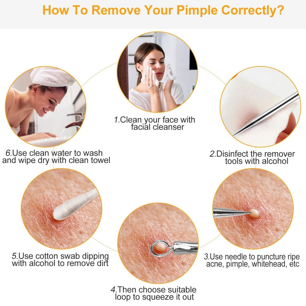5-Piece Set: Blackhead Remover Kit Stainless Steel Popping Zit Remover-5-Piece Set: Blackhead Remover Kit Stainless Steel Popping Zit Remover