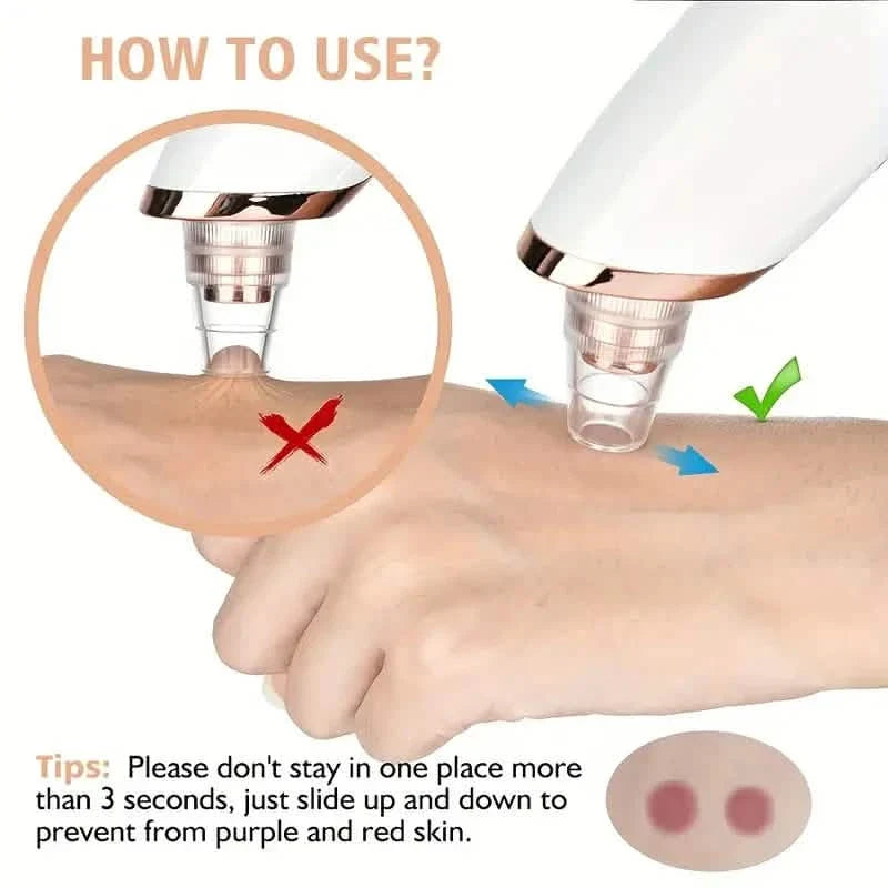 5-Suction Blackhead Removal Face Pore Cleaner-5-Suction Blackhead Removal Face Pore Cleaner