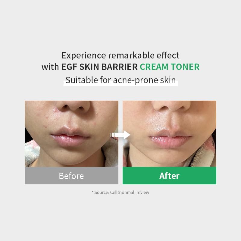 Z+PIDERM ECF Skin Barrier Cream Toner-Z+PIDERM ECF Skin Barrier Cream Toner