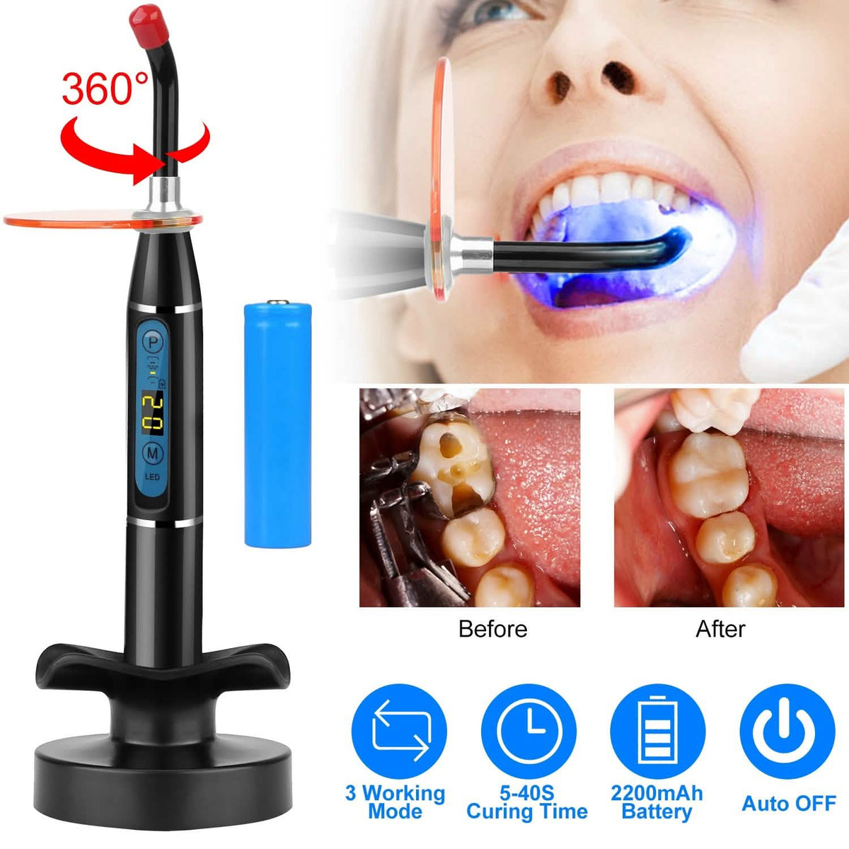 5W Cordless Dental LED Curing Light-5W Cordless Dental LED Curing Light