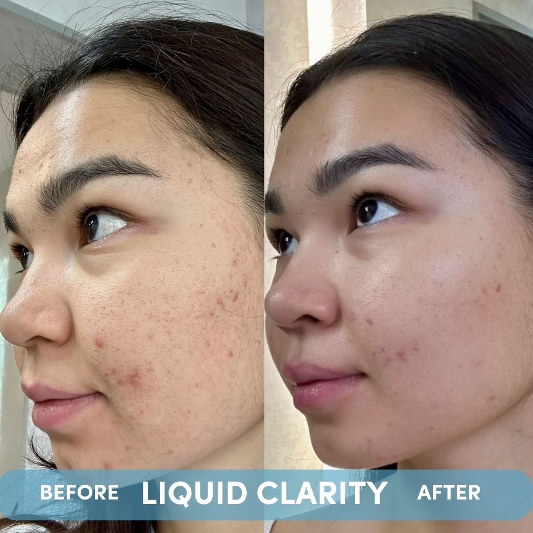 LIQUID CLARITY-LIQUID CLARITY