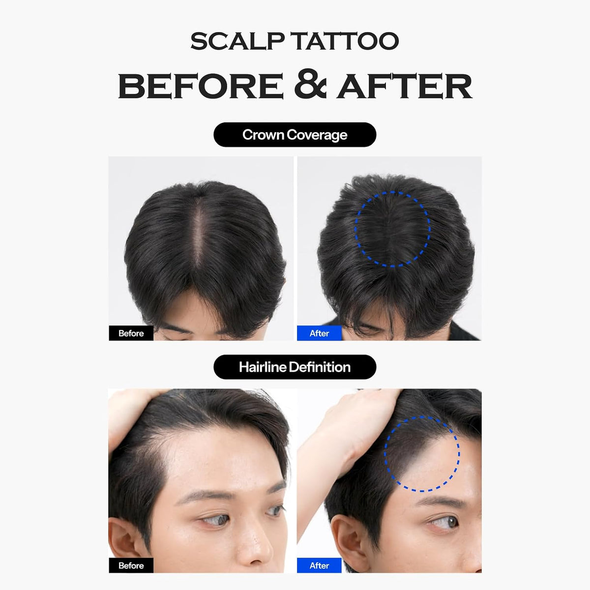 FORBEAUT Scalp Tattoo (Black)-FORBEAUT Scalp Tattoo (Black)