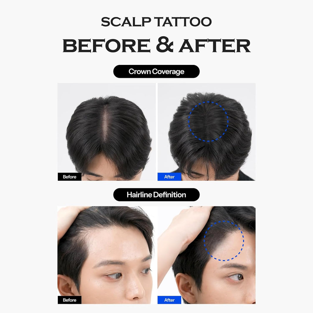 FORBEAUT Scalp Tattoo (Black)-FORBEAUT Scalp Tattoo (Black)