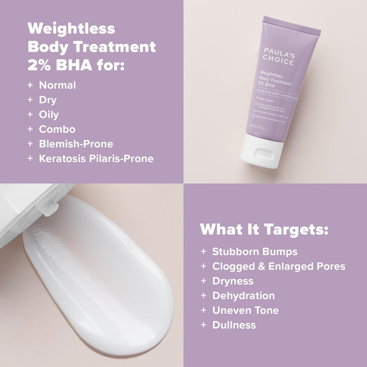 Paula's Choice Weightless Body Lotion Treatment 2% BHA, Salicylic Acid & Chamomile Lotion Exfoliant, Body Moisturizer for Keratosis Pilaris (KP) Prone Skin & Clogged Pores, Fragrance-Free-Paula's Choice Weightless Body Lotion Treatment 2% BHA, Salicylic Acid & Chamomile Lotion Exfoliant, Body Moisturizer for Keratosis Pilaris (KP) Prone Skin & Clogged Pores, Fragrance-Free