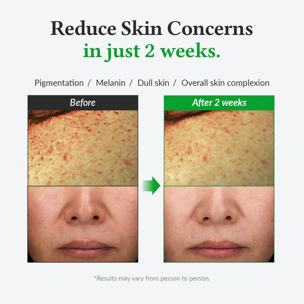 Dr. Althea Gentle Vitamin C Serum-Dr. Althea Gentle Vitamin C Serum