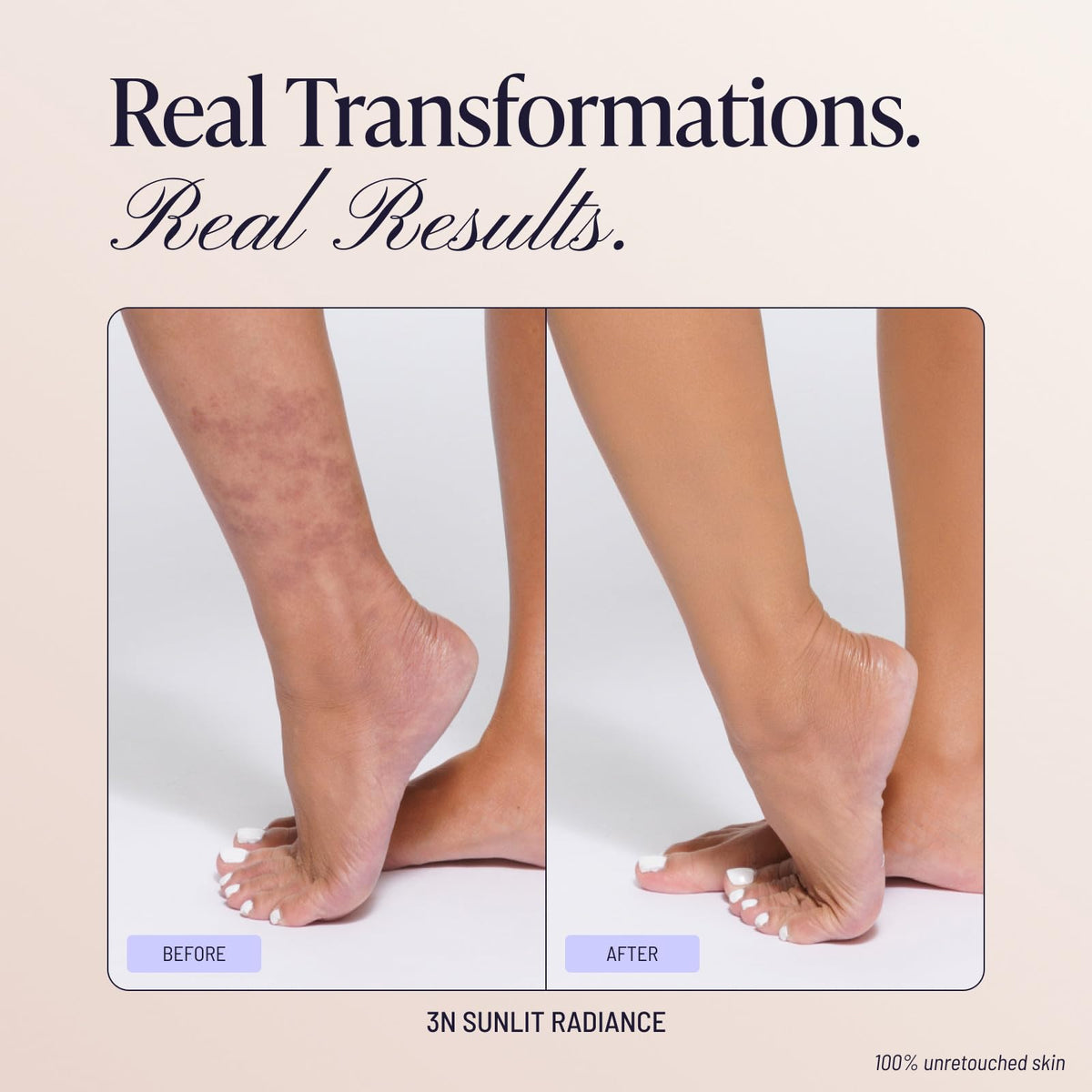 Westmore Beauty Body Coverage Perfector – Waterproof Leg & Body Makeup/Bronzer For Women - Best Tattoo Cover Up Makeup & Tattoo Concealer - 3.5 Oz Natural Radiance-Westmore Beauty Body Coverage Perfector – Waterproof Leg & Body Makeup/Bronzer For Women - Best Tattoo Cover Up Makeup & Tattoo Concealer - 3.5 Oz Natural Radiance