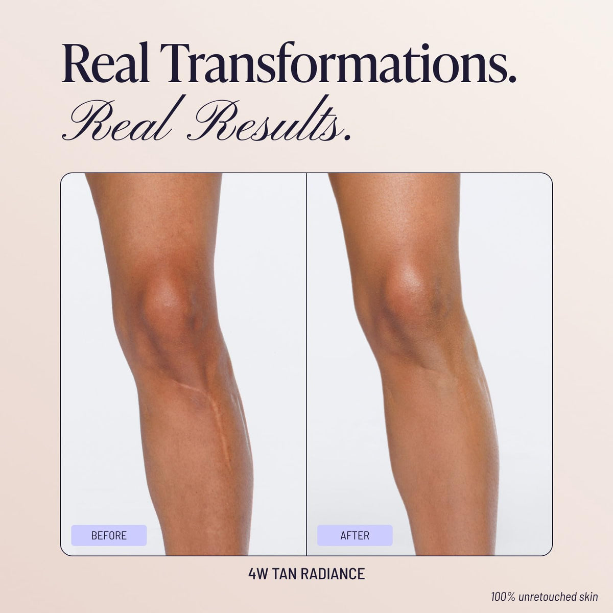 Westmore Beauty Body Coverage Perfector – Waterproof Leg & Body Makeup/Bronzer For Women - Best Tattoo Cover Up Makeup & Tattoo Concealer - 3.5 Oz Natural Radiance-Westmore Beauty Body Coverage Perfector – Waterproof Leg & Body Makeup/Bronzer For Women - Best Tattoo Cover Up Makeup & Tattoo Concealer - 3.5 Oz Natural Radiance