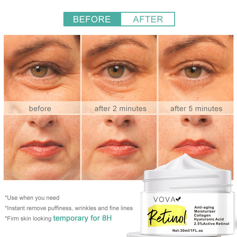 RETINOL ANTI-AGING MOISTURIZER FACE CREAM 30ML-46d56d813661535eba34edeacb0d0a18