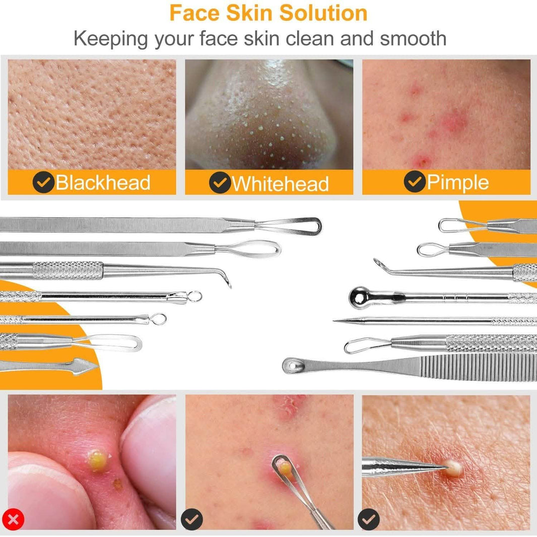 7-Pieces: Blackhead Remover Stainless Steel-7-Pieces: Blackhead Remover Stainless Steel