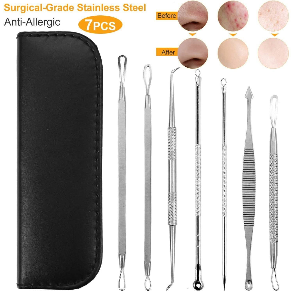 7-Pieces: Blackhead Remover Stainless Steel-7-Pieces: Blackhead Remover Stainless Steel