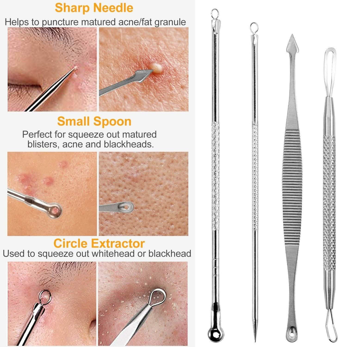 7-Pieces: Blackhead Remover Stainless Steel-7-Pieces: Blackhead Remover Stainless Steel