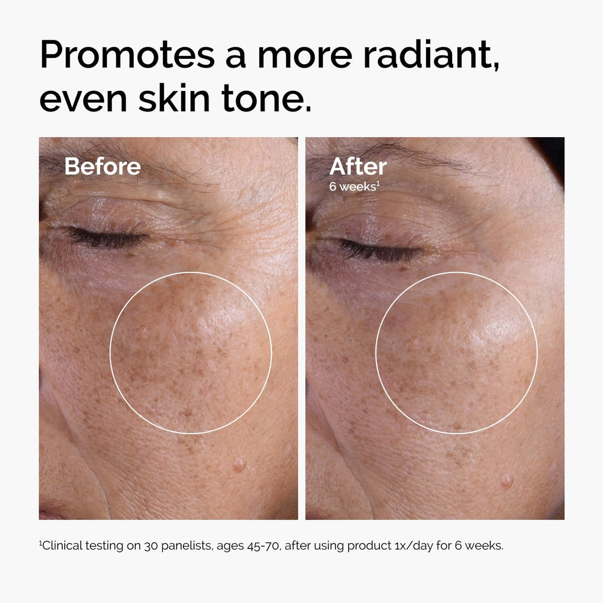 The Ordinary Glycolic Acid 7% Exfoliating Toner, Brightening and Smoothing Daily Toner for More Even-Looking Skin Tone-The Ordinary Glycolic Acid 7% Exfoliating Toner, Brightening and Smoothing Daily Toner for More Even-Looking Skin Tone