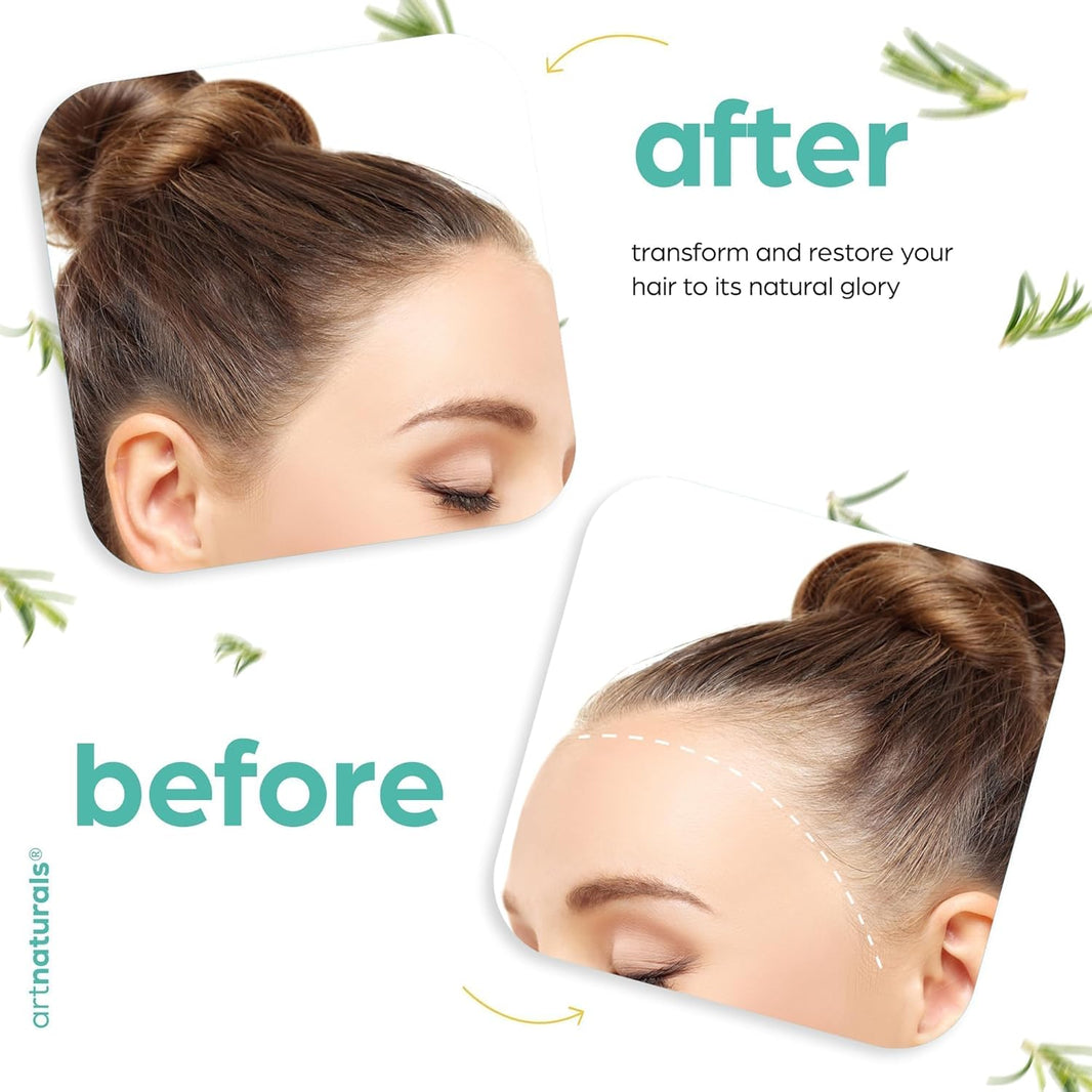 ArtNaturals Organic Rosemary Castor Hair Growth Tonic Oil + Massager Hair Regrowth Set, 4 oz with Coconut & Olive Oil, Scalp Treatment for Dry, Damaged & Split Ends-ArtNaturals Organic Rosemary Castor Hair Growth Tonic Oil + Massager Hair Regrowth Set, 4 oz with Coconut & Olive Oil, Scalp Treatment for Dry, Damaged & Split Ends