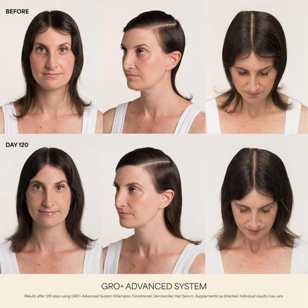 VEGAMOUR GRO+ Advanced Hair Serum | Improves Hair Density, Reduces Shedding and Promotes a Balanced Scalp | For Severe Signs of Thinning | Formulated Without Fragrance, Vegan, Cruelty-Free-VEGAMOUR GRO+ Advanced Hair Serum | Improves Hair Density, Reduces Shedding and Promotes a Balanced Scalp | For Severe Signs of Thinning | Formulated Without Fragrance, Vegan, Cruelty-Free