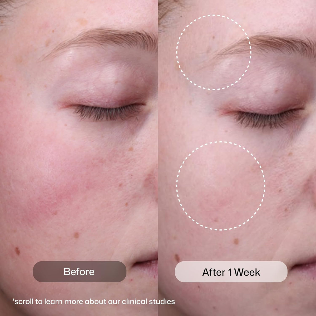 Revison Skincare Radiance+ Resurfacing Serum, Overnight AHA+BHA+PHA Exfoliating Serum with Glycolic Acid & Salicylic Acid | Smooths Uneven Texture, Clears Pores & Brightens Dull Skin, 1oz-Revison Skincare Radiance+ Resurfacing Serum, Overnight AHA+BHA+PHA Exfoliating Serum with Glycolic Acid & Salicylic Acid | Smooths Uneven Texture, Clears Pores & Brightens Dull Skin, 1oz