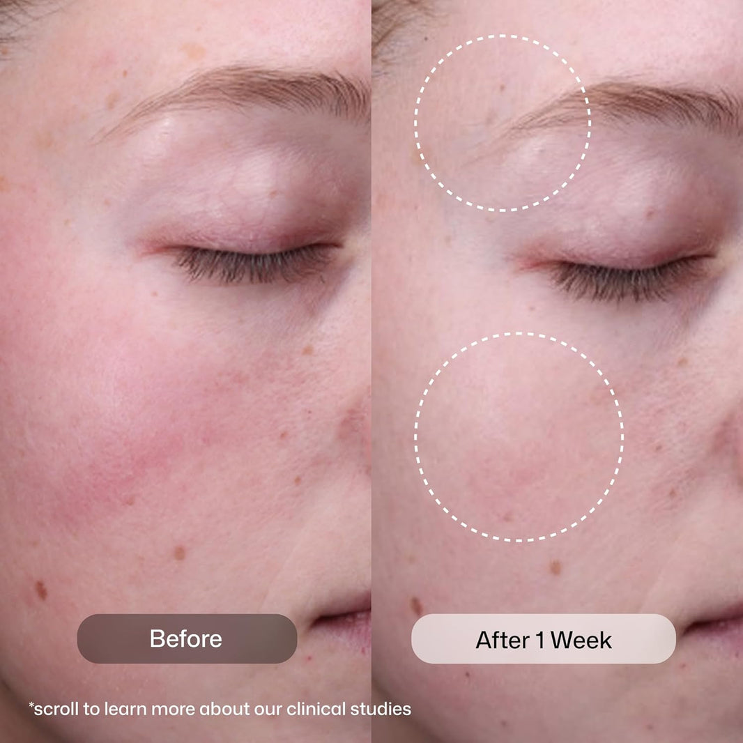 Revison Skincare Radiance+ Resurfacing Serum, Overnight AHA+BHA+PHA Exfoliating Serum with Glycolic Acid & Salicylic Acid | Smooths Uneven Texture, Clears Pores & Brightens Dull Skin, 1oz-Revison Skincare Radiance+ Resurfacing Serum, Overnight AHA+BHA+PHA Exfoliating Serum with Glycolic Acid & Salicylic Acid | Smooths Uneven Texture, Clears Pores & Brightens Dull Skin, 1oz