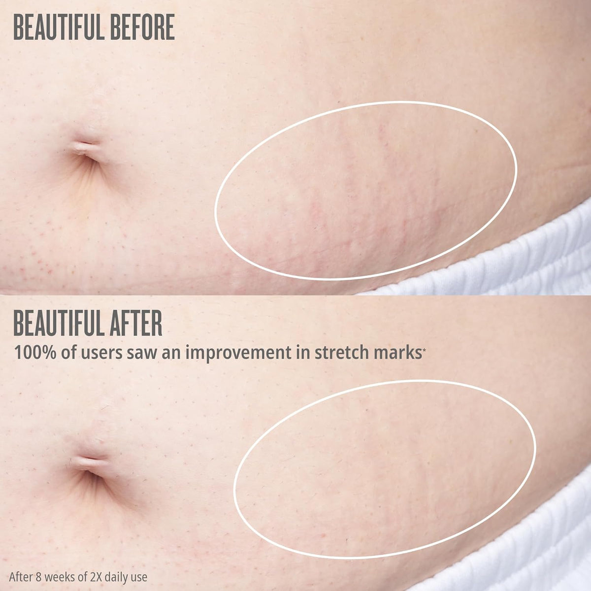 Sol de Janeiro Bum Bum Firmeza Body Oil - Stretch Mark Oil-Sol de Janeiro Bum Bum Firmeza Body Oil - Stretch Mark Oil