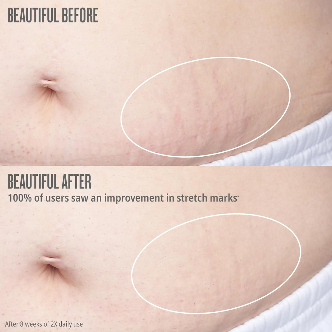 Sol de Janeiro Bum Bum Firmeza Body Oil - Stretch Mark Oil-Sol de Janeiro Bum Bum Firmeza Body Oil - Stretch Mark Oil