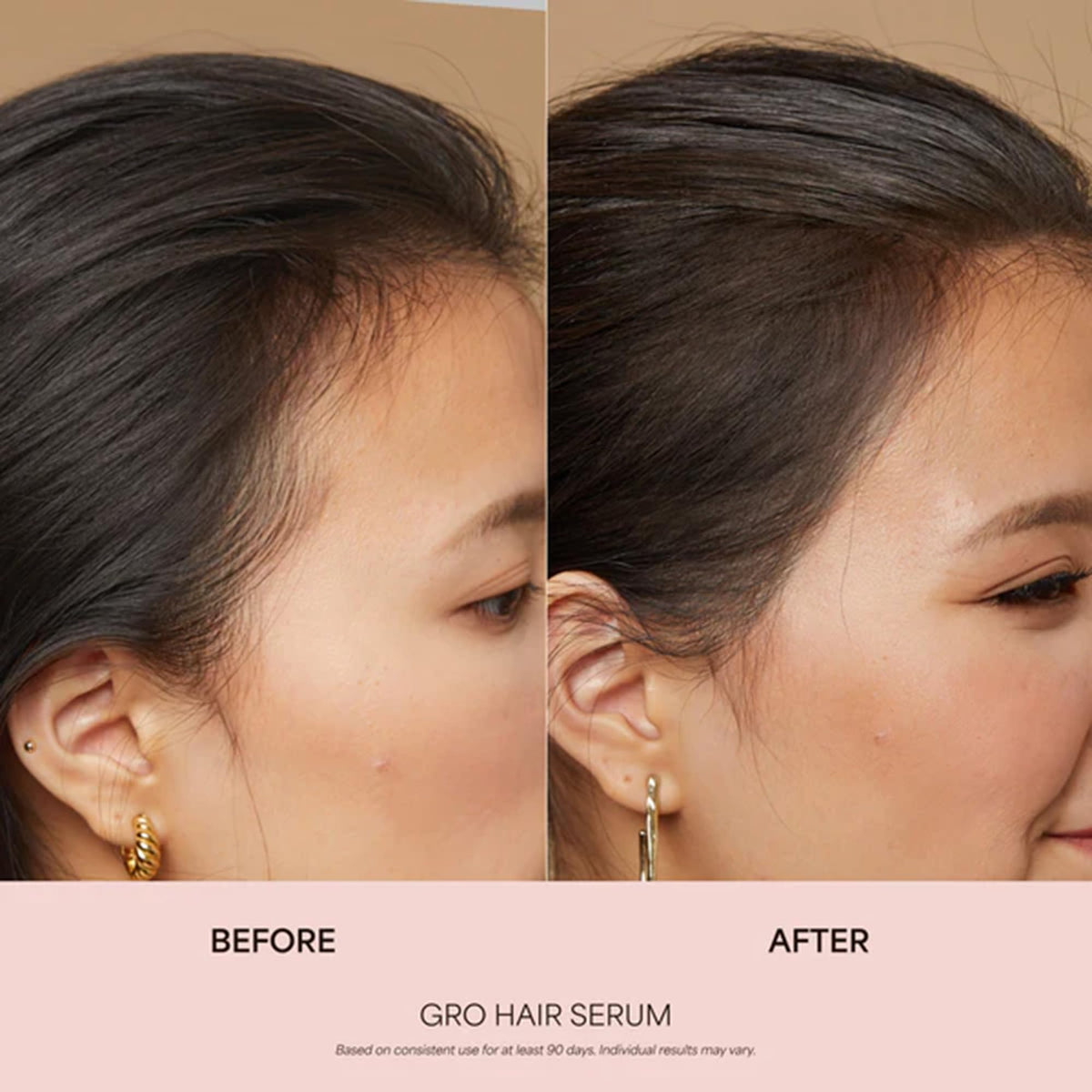VEGAMOUR GRO Hair Serum for Hair Thinning & Shedding, Thicker Fuller Looking Hair In As Soon As 90 Days, Non Oily, Bergamot Scent, Vegan & Cruelty Free-VEGAMOUR GRO Hair Serum for Hair Thinning & Shedding, Thicker Fuller Looking Hair In As Soon As 90 Days, Non Oily, Bergamot Scent, Vegan & Cruelty Free
