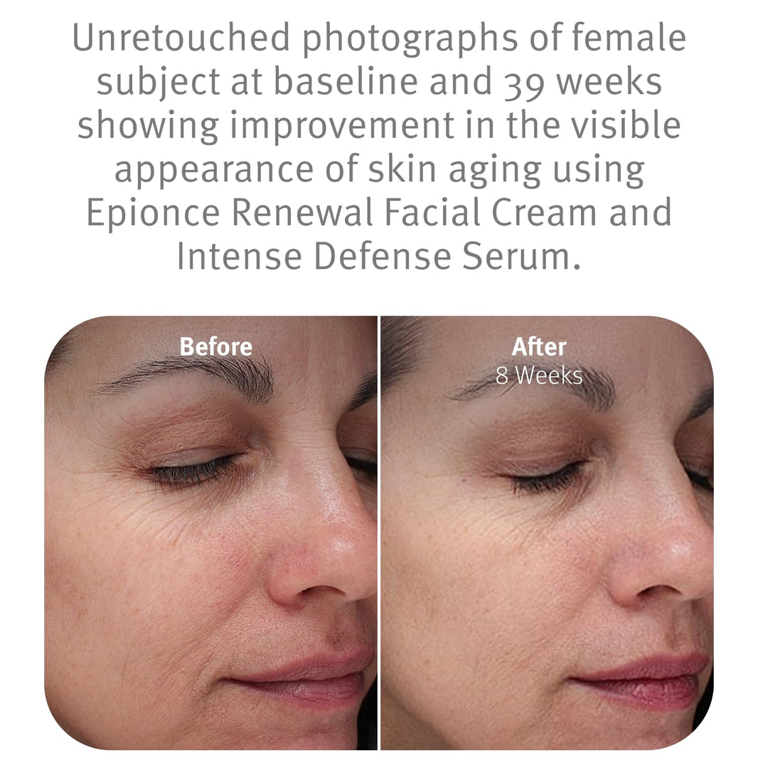 Epionce Renewal Facial Cream – Hydrating Anti-Aging Moisturizer | For Dry, Sensitive to Normal Skin | Fine Lines & Wrinkles | Dermatologist Skincare-Epionce Renewal Facial Cream – Hydrating Anti-Aging Moisturizer | For Dry, Sensitive to Normal Skin | Fine Lines & Wrinkles | Dermatologist Skincare