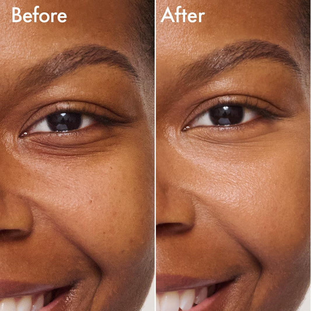 Catrice | Under Eye Brightener | Conceal & Brighten Dark Circles | With Hyaluronic Acid & Shea Butter | Vegan, Cruelty Free & Paraben Free (010 | Light Rose)-Catrice | Under Eye Brightener | Conceal & Brighten Dark Circles | With Hyaluronic Acid & Shea Butter | Vegan, Cruelty Free & Paraben Free (010 | Light Rose)