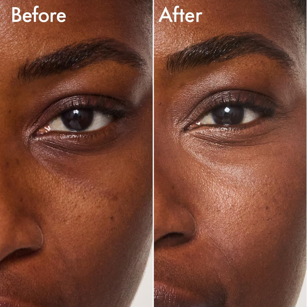 Catrice | Under Eye Brightener | Conceal & Brighten Dark Circles | With Hyaluronic Acid & Shea Butter | Vegan, Cruelty Free & Paraben Free (010 | Light Rose)-Catrice | Under Eye Brightener | Conceal & Brighten Dark Circles | With Hyaluronic Acid & Shea Butter | Vegan, Cruelty Free & Paraben Free (010 | Light Rose)