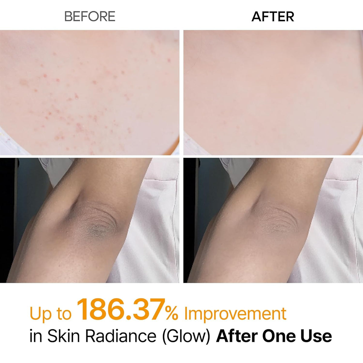 Dr. Melaxin Peel Shot Exfoliating Kojic Acid Turmeric Spray-Dr. Melaxin Peel Shot Exfoliating Kojic Acid Turmeric Spray