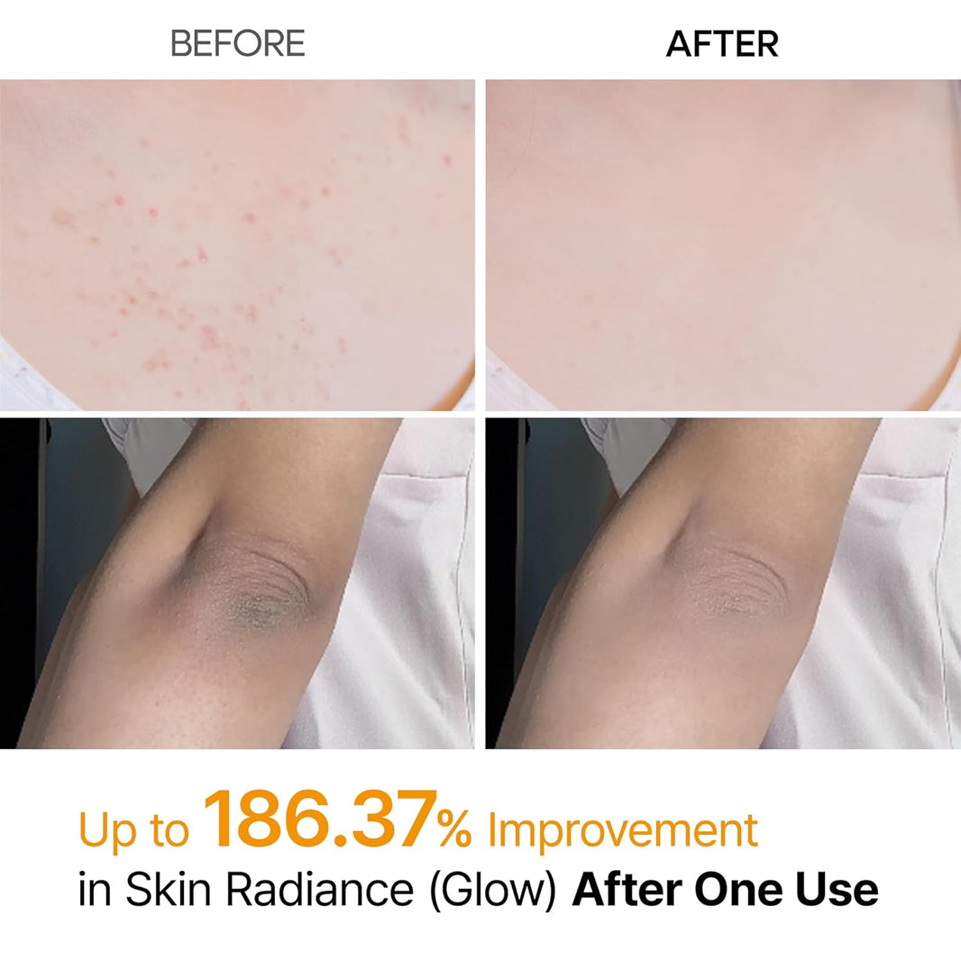 Dr. Melaxin Peel Shot Exfoliating Kojic Acid Turmeric Spray-Dr. Melaxin Peel Shot Exfoliating Kojic Acid Turmeric Spray
