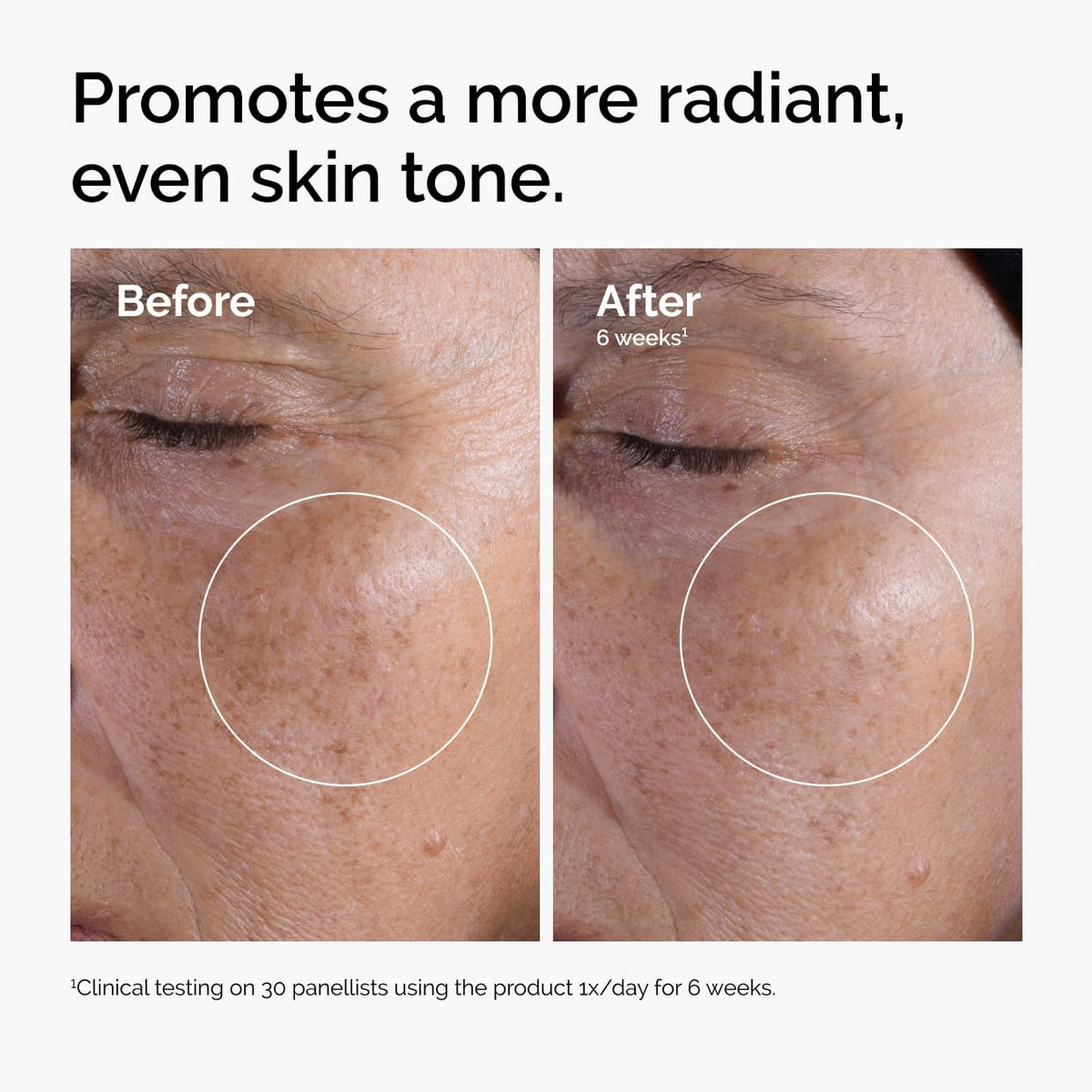 The Ordinary Glycolic Acid 7% Exfoliating Toner, Brightening and Smoothing Daily Toner for More Even-Looking Skin Tone-The Ordinary Glycolic Acid 7% Exfoliating Toner, Brightening and Smoothing Daily Toner for More Even-Looking Skin Tone