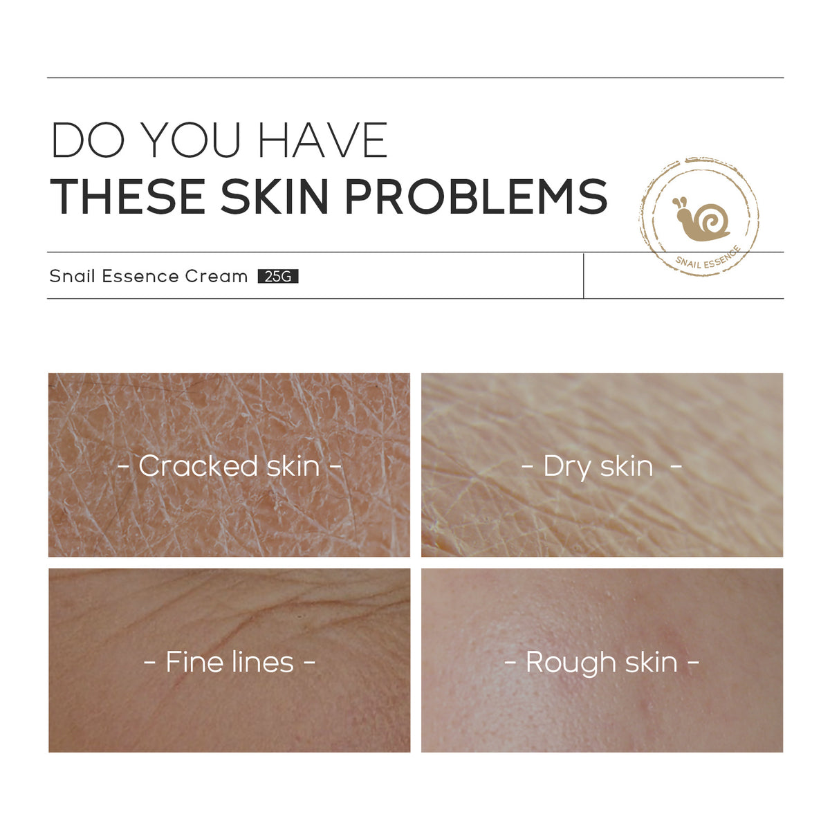 Moisturizing Skin Care Products Laikou Snail Cream-2b3b0581887eafaa628f76959b0833c5