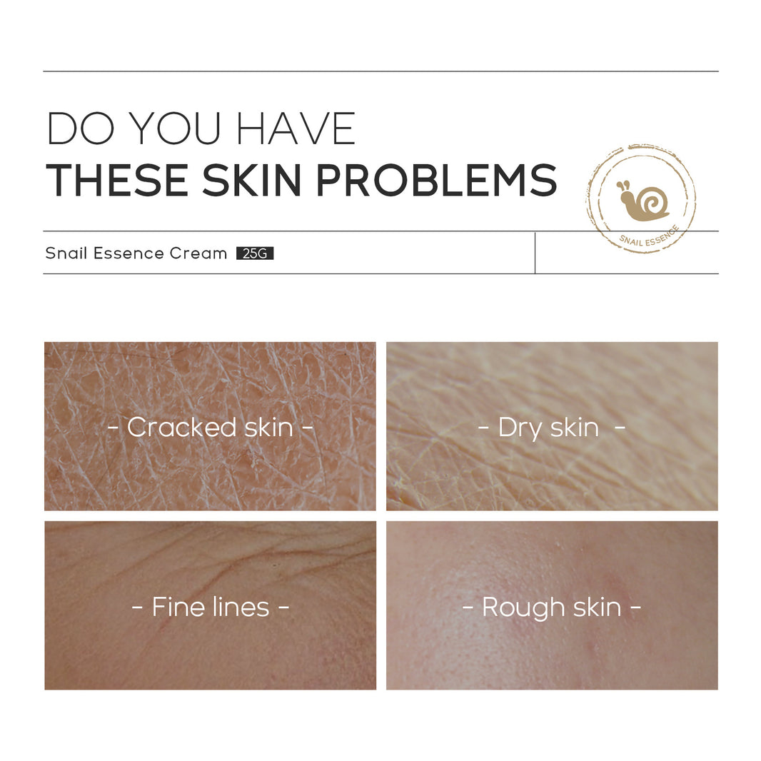 Moisturizing Skin Care Products Laikou Snail Cream-2b3b0581887eafaa628f76959b0833c5